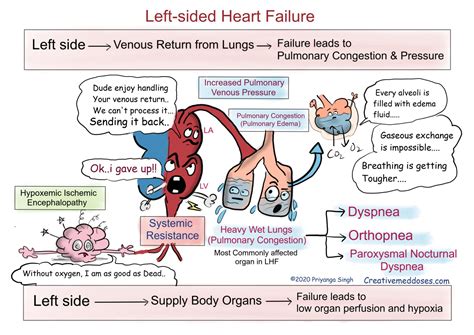 Heart Failure Left Sided Vs Right Sided Creative Med Doses