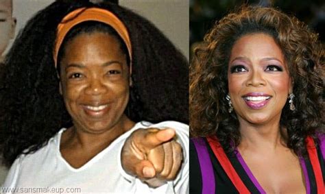 Oprah Winfrey Nose Job Before And After Photo Celebrity Plastic Surgery