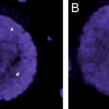 Interphase Fluorescence In Situ Hybridization With The Dual Color