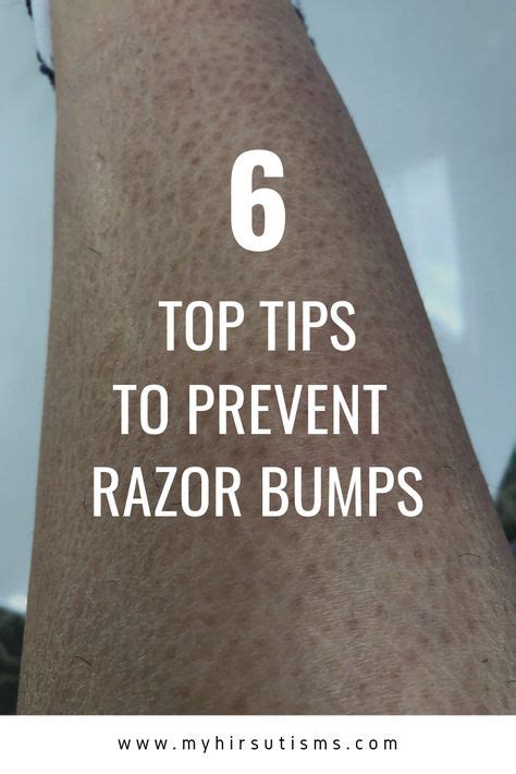 Razor Bumps And Strawberry Legs How To Prevent And Treat Them Razor