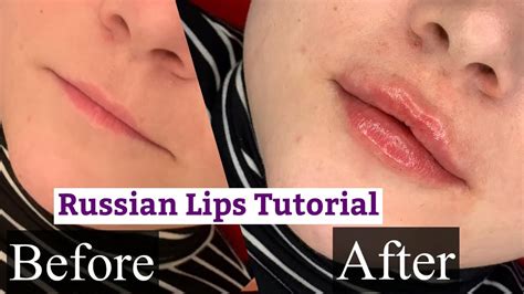 Russian Lips Super Thin Lips With Before And After 2021 Youtube
