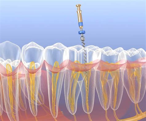 what is the difference between periodontist vs endodontist