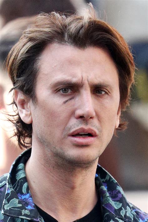 Ouch Jonathan Cheban Caught With Nasty Bruise Under His Eye