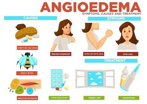 Premium Vector Angioedema Symptom Causes And Treatment Of Disease