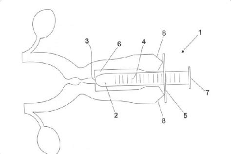 Schematic View Of The Device For Measuring The Vaginal Canal