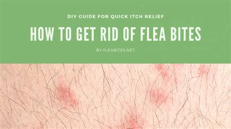 Flea Bite Treatment How To Get Rid Of Flea Bites Fleabites