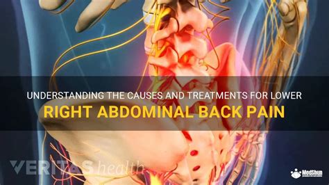 Understanding The Causes And Treatments For Lower Right Abdominal Back Pain Medshun
