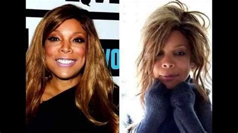 Wendy Williams Plastic Surgery Before And After Youtube