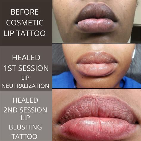 Lighten Dark Lips Before And After