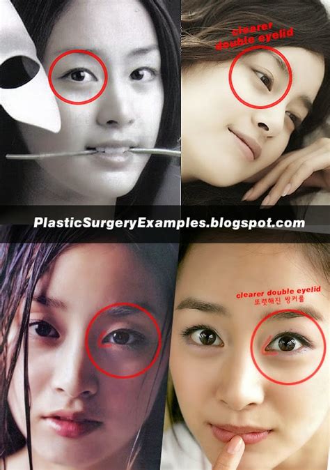 She looked having no enhancement. Plastic Surgery Examples: Kim Tae Hee plastic surgery ...