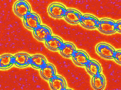 Chains Of Streptococcus Pyogenes Bacteria Photograph By Alfred Pasieka