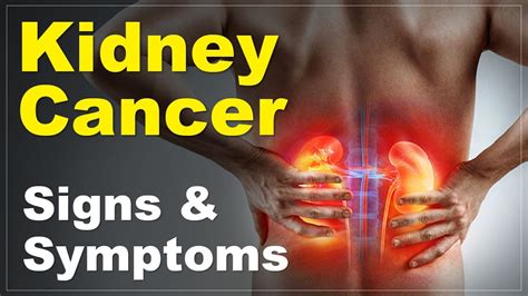 Signs And Symptoms Of Kidney Cancer By Cancerclinix Youtube