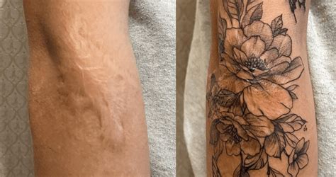 Update More Than Pitted Skin Tattoo Super Hot In Eteachers