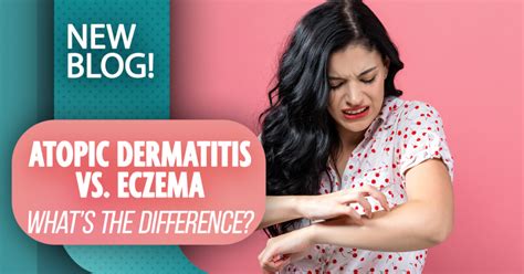 Atopic Dermatitis Vs Eczema Whats The Difference Activmed