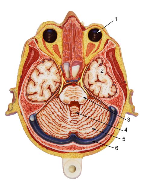 Brain Axial Section