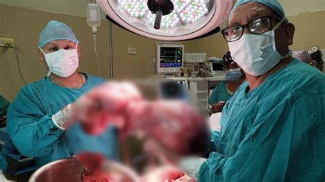 los casos más llamativos de tumores extirpados en el perú hubo uno de 36 kilos infobae