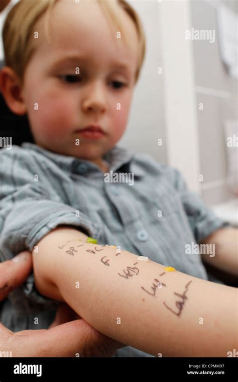 Allergy Test Child Stock Photo Alamy