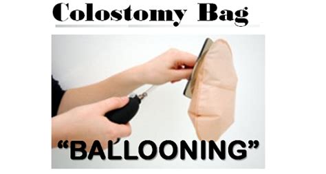 How To Prevent Colostomy Bag Ballooning Healdove