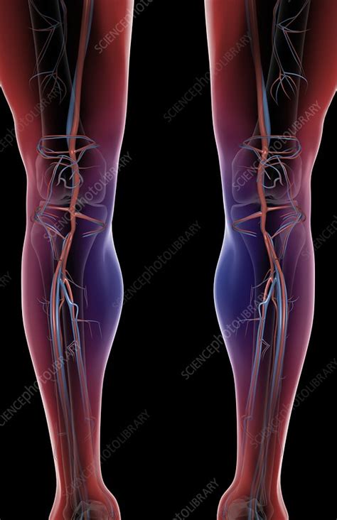 The Blood Vessels Of The Leg Stock Image C0080674 Science Photo