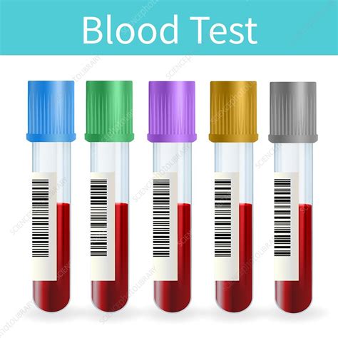 Blood Sample Tubes Illustration Stock Image F0250117 Science