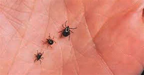 Keep Ticks Off Of You All Summer Long With This Simple Trick
