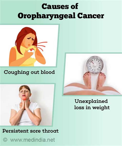 Oropharyngeal Cancer Symptoms