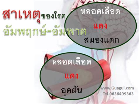 อัมพฤกษ์ อัมพาต หรือ cerebrovascular accident (cva) เป็นอาการของโรคหลอดเลือดในสมอง หรือ stroke เกิดจากการที่เซลล์สมองขาด. อัมพฤกษ์ อัมพาต รู้ก่อน รอดปลอดภัยด้วยเซซามิน นวัตกรรมใหม่ ...