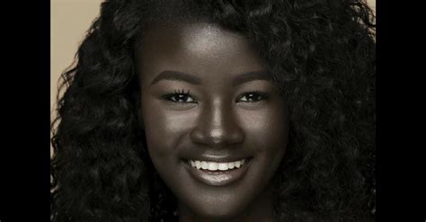 Teen Bullied For Incredibly Dark Skin Color Becomes Model Takes