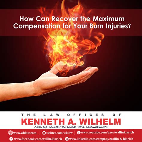 How Can Recover The Maximum Compensation For Your Burn Injuries Burn