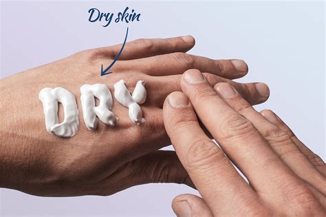 Dry Skin Causes And Treatment