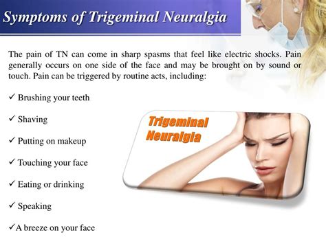 What Is Trigeminal Neuralgia And Causes Of Trigeminal Neuralgia