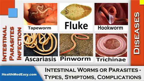 Worm Parasite Identification Chart