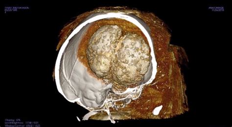 brain of 3 200 year old egyptian mummy hatason revealed through ct scans