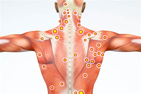 A pulled muscle in the lower back can make everyday activities, such as sleeping and working, extremely difficult. Muscle Trigger Point Pain & Myofascial Release Therapy ...