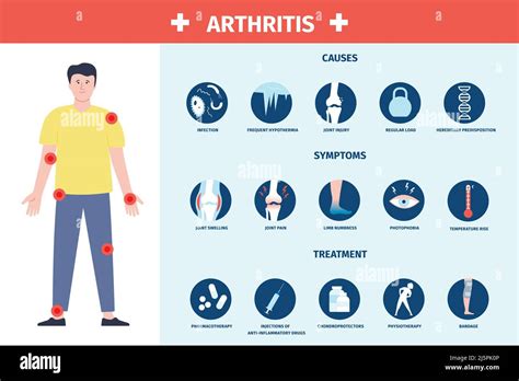 Arthritis infographic. Inflammation and care, symptoms and treatment