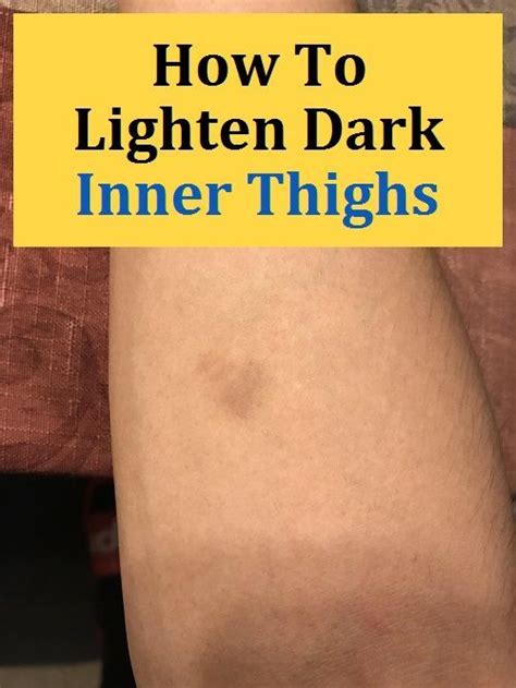 How To Lighten Dark Inner Thighs How To Lighten Dark Inner Thigh