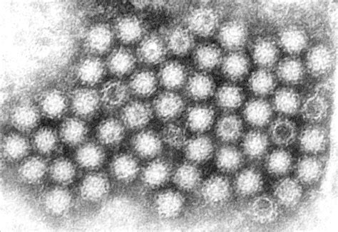 Free Picture Noroviruses Group Viruses Stomach Flu Gastroenteritis