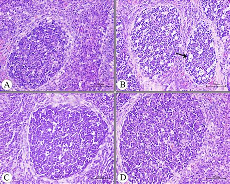 Histological Structure Of The Diffuse Lymphoid Tissue And Lymphatic