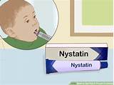 Thrush Medication For Infants Pictures