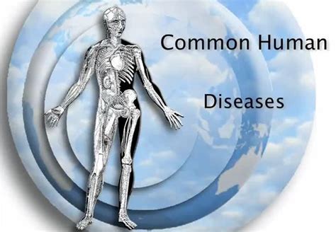 Common Human Diseases Cev70157