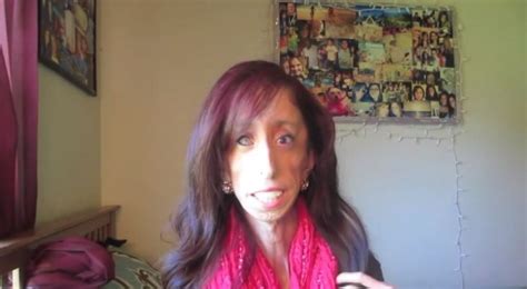 Lizzie Velasquez Worlds Thinnest Woman Beats Bullies To Become