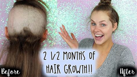 2 12 Month Of Hair Growth Youtube