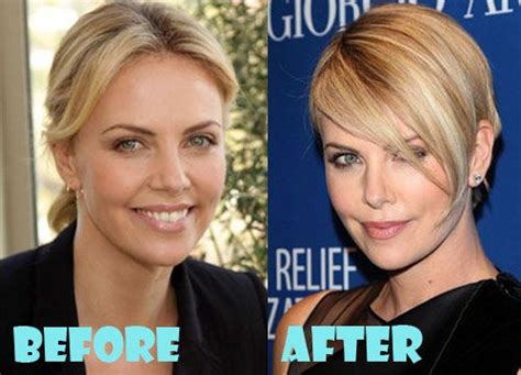 Charlize Theron Plastic Surgery Before And After Pictures Plastic