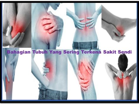Perubatan Natural Sakit Sendi Otot Dan Tulang