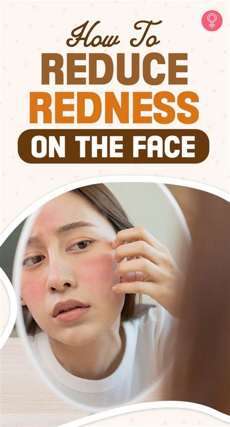 Home Remedies To Reduce Redness On The Face Artofit
