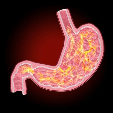 Stomach acid is essential to proper digestion. Hydrochloric Acid: Improve Your Digestion | Beautiful On Raw