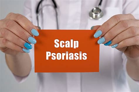 Arenabytes Scalp Psoriasis Signs Causes Home Remedies And Food