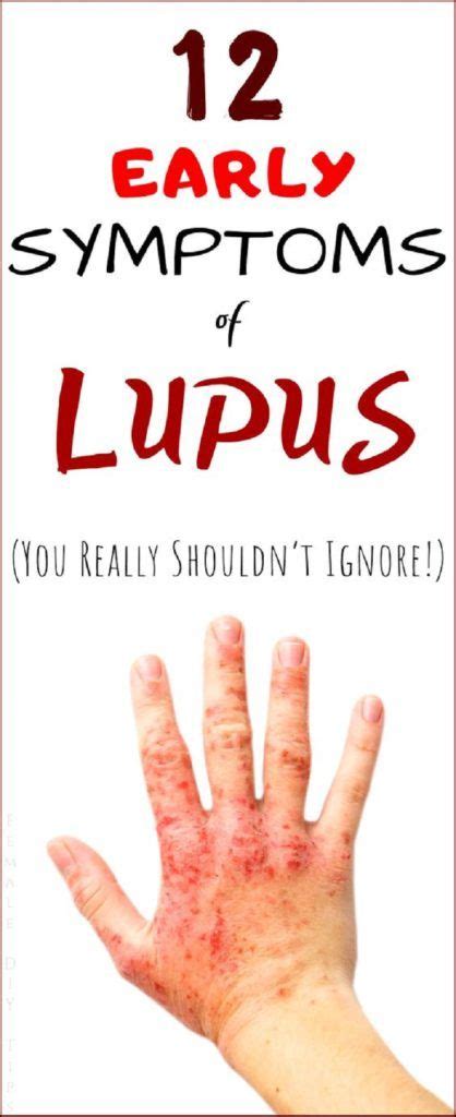 12 Early Warning Signs Of Lupus You Really Shouldnt Ignore Lupus