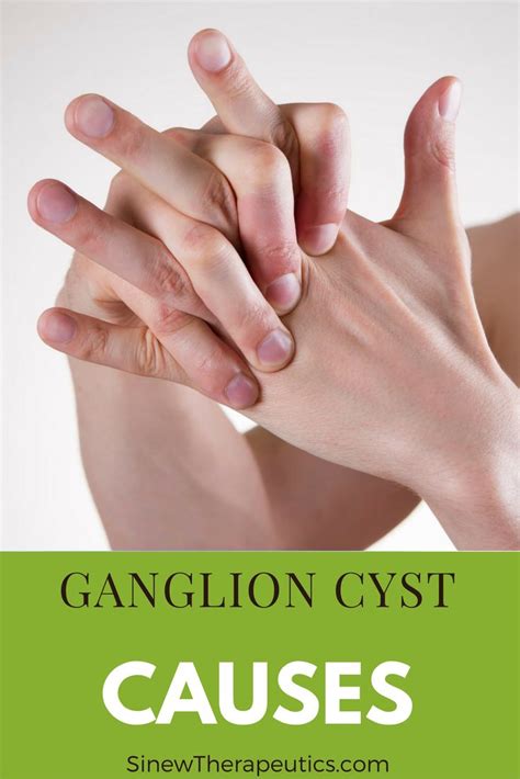 Pin On Ganglion Cyst