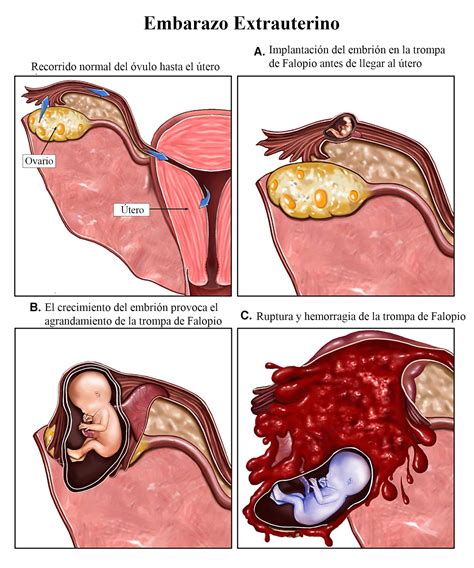 Menstruación durante el embarazo píldora normal posible primer mes